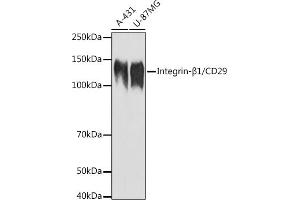 Western blot analysis of extracts of various cell lines, using Integrin-β1/CD29 antibody (ABIN6134032, ABIN6142578, ABIN6142579 and ABIN6219452) at 1:1000 dilution. (ITGB1 抗体  (AA 600-700))