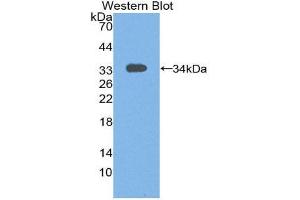 Western Blotting (WB) image for anti-Signal Transducing Adaptor Molecule (SH3 Domain and ITAM Motif) 1 (STAM) (AA 199-464) antibody (ABIN3206390) (STAM 抗体  (AA 199-464))