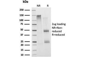 SDS-PAGE Analysis Purified Histone H1 Mouse Monoclonal Antibody (1415-1). (Histone H1 抗体)