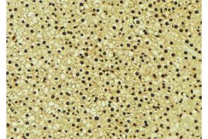 Immunohistochemistry (IHC) image for anti-Nuclear Receptor Subfamily 1, Group I, Member 2 (NR1I2) (C-Term) antibody (ABIN6263716)