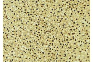 ABIN6276741 at 1/100 staining Mouse liver tissue by IHC-P.