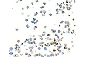 Immunocytochemistry (ICC) image for anti-CD28 (CD28) (AA 19-140) antibody (ABIN7448899) (Recombinant CD28 抗体  (AA 19-140))