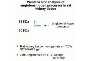 Western Blot analysis of antigiotensinogen precursor in rat kidney tissue. (AGT 抗体  (AA 1-7))