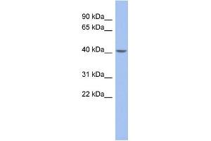 WB Suggested Anti-ZNF302 Antibody Titration:  0. (ZNF302 抗体  (Middle Region))