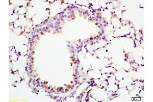 Formalin-fixed and paraffin embedded rat lung labeled with Anti-ADCY10 Polyclonal Antibody, Unconjugated (ABIN751093) at 1:200 followed by conjugation to the secondary antibody and DAB staining (ADCY10 抗体  (AA 1101-1200))