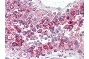 Immunohistochemistry (IHC) image for anti-Vesicle-Associated Membrane Protein 2 (Synaptobrevin 2) (VAMP2) (AA 1-89), (N-Term) antibody (ABIN317061)