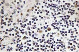 Immunohistochemistry analysis of TAL1 Antibody in paraffin-embedded human lymph node tissue. (TAL1 抗体)