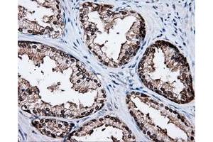 Immunohistochemistry (IHC) image for anti-Tubulin tyrosine Ligase-Like Family, Member 12 (TTLL12) antibody (ABIN1499035) (TTLL12 抗体)