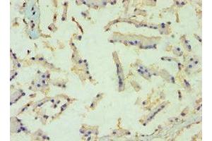 Immunohistochemistry of paraffin-embedded human prostate tissue using ABIN7152459 at dilution of 1:100 (TBL1XR1 抗体  (AA 1-180))