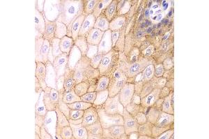 Immunohistochemistry of paraffin-embedded human esophagus using CLDN1 antibody (ABIN5971222) at dilution of 1/100 (40x lens). (Claudin 1 抗体)