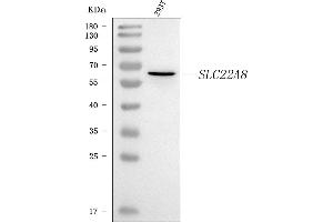 Western blot analysis of OAT3/SLC22A8 using anti-OAT3/SLC22A8 antibody (ABIN7599422).