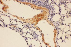 Anti-Adiponectin Picoband antibody,  IHC(P): Mouse Lung Tissue (ADIPOQ 抗体  (AA 19-244))