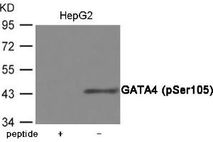 Western blot analysis of extracts from HepG2 cells using GATA4 (Phospho-Ser105) Antibody. (GATA4 抗体  (pSer105))