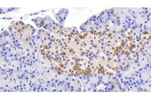 Detection of Slit2 in Human Pancreas Tissue using Polyclonal Antibody to Slit Homolog 2 (Slit2) (SLIT2 抗体  (AA 664-777))