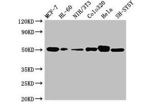 Western Blot Positive WB detected in: MCF-7 whole cell lysate, HL60 whole cell lysate, NIH/3T3 whole cell lysate, Colo320 whole cell lysate, Hela whole cell lysate, SH-SY5Y whole cell lysate All lanes: CALR antibody at 2 μg/mL Secondary Goat polyclonal to rabbit IgG at 1/10000 dilution Predicted band size: 49 kDa Observed band size: 49 kDa (Calreticulin 抗体  (AA 18-417))