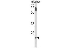 Western Blotting (WB) image for anti-Survival Motor Neuron Domain Containing 1 (SMNDC1) (AA 19-48), (N-Term) antibody (ABIN954854)