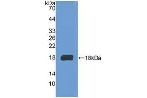 Detection of Recombinant COL3a1, Mouse using Polyclonal Antibody to Collagen Type III Alpha 1 (COL3a1) (COL3A1 抗体  (AA 1224-1371))