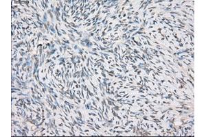 Immunohistochemical staining of paraffin-embedded colon tissue using anti-FCGR2A mouse monoclonal antibody. (FCGR2A 抗体)