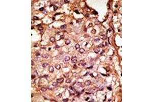 Image no. 1 for anti-Chemokine Binding Protein 2 (CCBP2) (N-Term) antibody (ABIN357385) (CCBP2 抗体  (N-Term))