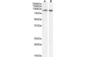 ABIN6391388 (0. (FBXO11 抗体  (AA 754-765))