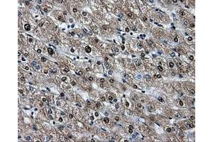 Immunohistochemical staining of paraffin-embedded liver tissue using anti-HSPA1Amouse monoclonal antibody. (HSP70 1A 抗体)