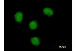 Immunofluorescence of purified MaxPab antibody to NOVA1 on HeLa cell. (NOVA1 抗体  (AA 1-507))
