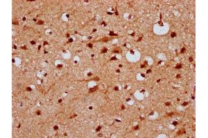 IHC image of ABIN7157277 diluted at 1:300 and staining in paraffin-embedded human brain tissue performed on a Leica BondTM system. (KLHL2 抗体  (AA 1-200))