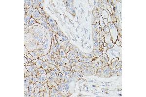 Immunohistochemistry (IHC) image for anti-Thrombomodulin (THBD) (AA 200-500) antibody (ABIN1683026)