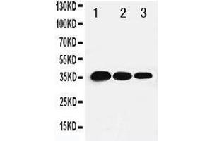 Lane 3: Recombinant Human TBX21 Protein 1. (T-Bet 抗体  (C-Term))