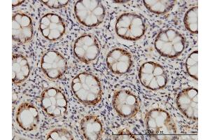 Immunostaining (ISt) image for anti-Proteasome (Prosome, Macropain) Subunit, beta Type, 6 (PSMB6) (AA 1-239) antibody (ABIN562482)
