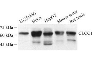 Western blot analysis of CLCC1 (ABIN7073473) at dilution of 1: 500 (CLCC1 抗体)