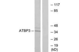 Western blot analysis of extracts from LOVO cells, using ATPBD3 Antibody. (ATPBD3 抗体  (AA 291-340))