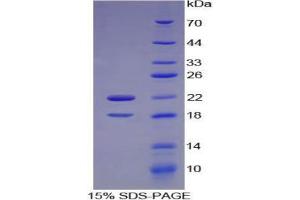 SDS-PAGE analysis of Mouse CSF2Ra Protein. (CSF2RA 蛋白)