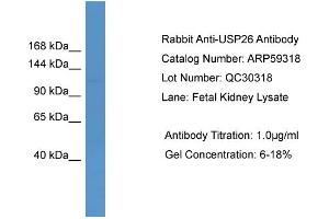 WB Suggested Anti-USP26  Antibody Titration: 0. (USP26 抗体  (Middle Region))
