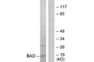 Western Blotting (WB) image for anti-BCL2-Associated Agonist of Cell Death (BAD) (AA 102-151) antibody (ABIN2888955) (BAD 抗体  (AA 102-151))