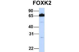 Host:  Rabbit  Target Name:  FOXK2  Sample Type:  721_B  Antibody Dilution:  1. (Forkhead Box K2 抗体  (Middle Region))