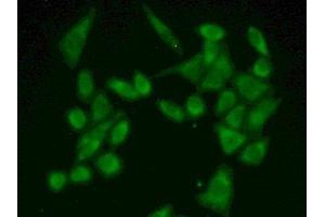 Detection of FUM in Human Hela Cell using Polyclonal Antibody to Fumarase (FUM) (FH 抗体  (AA 45-188))