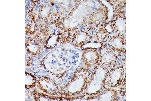 Immunohistochemistry (IHC) image for anti-Isocitrate Dehydrogenase 3 (NAD+) alpha (IDH3A) (AA 28-366) antibody (ABIN7268029)