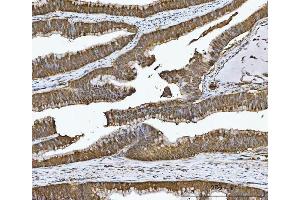 IHC analysis of CA1 using anti-CA1 antibody (ABIN3043766).