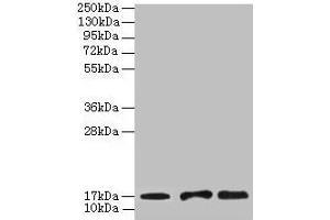 Western blot All lanes: UBE2D1 antibody at 2 μg/mL Lane 1: Mouse thymus tissue Lane 2: NIH/3T3 whole cell lysate Lane 3: Jurkat whole cell lysate Secondary Goat polyclonal to rabbit IgG at 1/10000 dilution Predicted band size: 17 kDa Observed band size: 17 kDa (UBE2D1 抗体  (AA 1-147))
