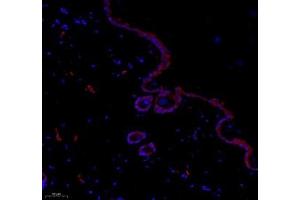 Immunofluorescence of paraffin embedded rat skin using paldadin (ABIN7074976) at dilution of 1: 500 (200x lens) (PALLD 抗体)