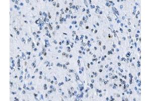 IHC analysis of MTA2 using anti-MTA2 antibody (ABIN7599519). (MTA2 抗体  (AA 1-668))