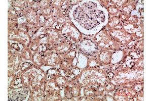 Immunohistochemical analysis of paraffin-embedded human-kidney, antibody was diluted at 1:200 (HMMR 抗体  (AA 280-340))