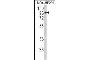 Western blot analysis of BAHD1 Antibody in MDA-MB231 cell line lysates (35ug/lane) (BAHD1 抗体  (C-Term))