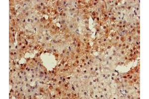 Immunohistochemistry of paraffin-embedded human adrenal gland tissue using ABIN7146610 at dilution of 1:100 (PKIB 抗体  (AA 1-77))