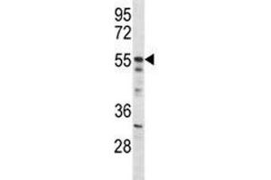Akt2 antibody western blot analysis in mouse NIH3T3 lysate (AKT2 抗体  (AA 93-122))