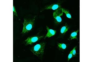 IF analysis of CARD9 using anti-CARD9 antibody (ABIN7599386). (CARD9 抗体  (AA 1-429))