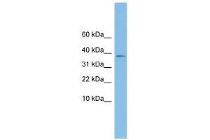 KLHDC9 antibody used at 1 ug/ml to detect target protein. (KLHDC9 抗体  (Middle Region))