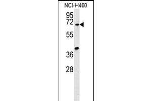 SYN3 Antibody (Center) (ABIN651941 and ABIN2840467) western blot analysis in NCI- cell line lysates (15 μg/lane). (Synapsin III 抗体  (AA 363-388))