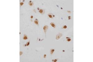 D staining MeCP2 in human brain tissue sections by Immunohistochemistry (IHC-P - paraformaldehyde-fixed, paraffin-embedded sections).